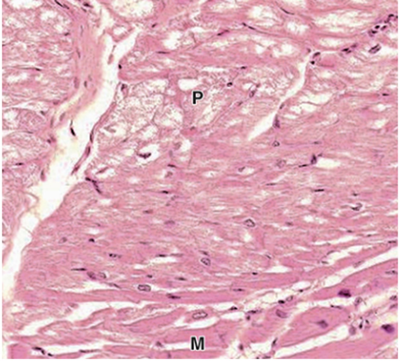 <p>Where are the myofibrils located in Purkinje fibers?</p>