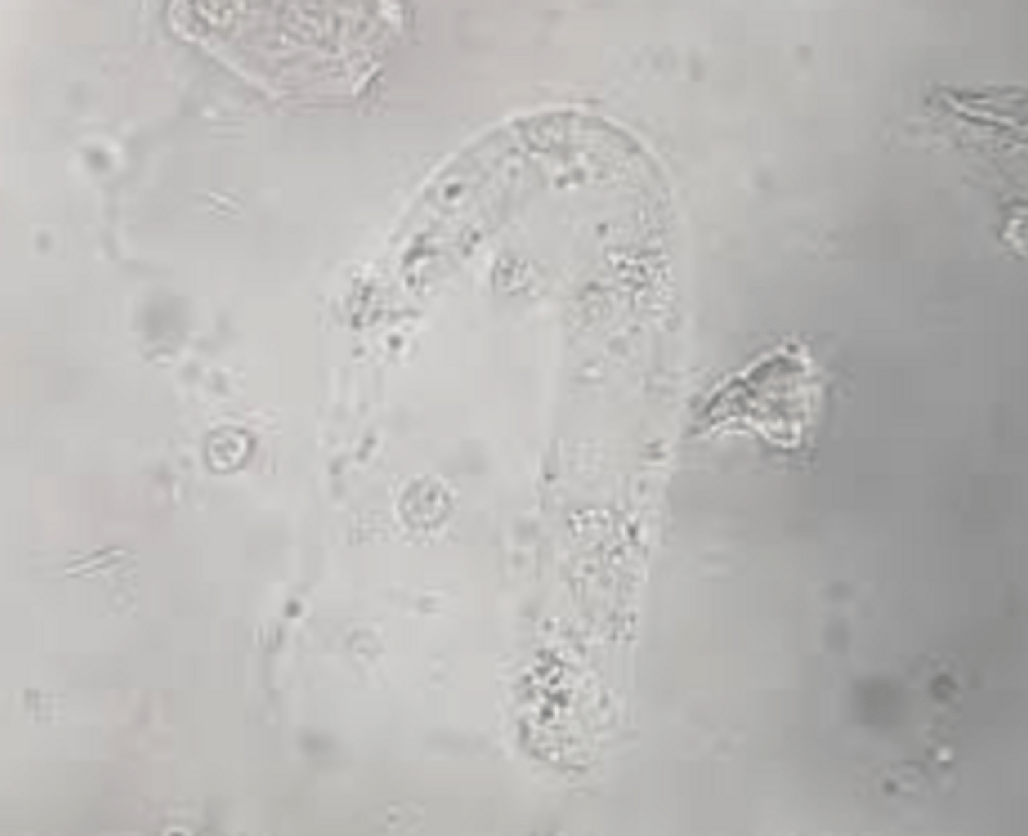 <p>- Look similar to hyaline casts but have tapered end</p><p>- Not really any indications</p>