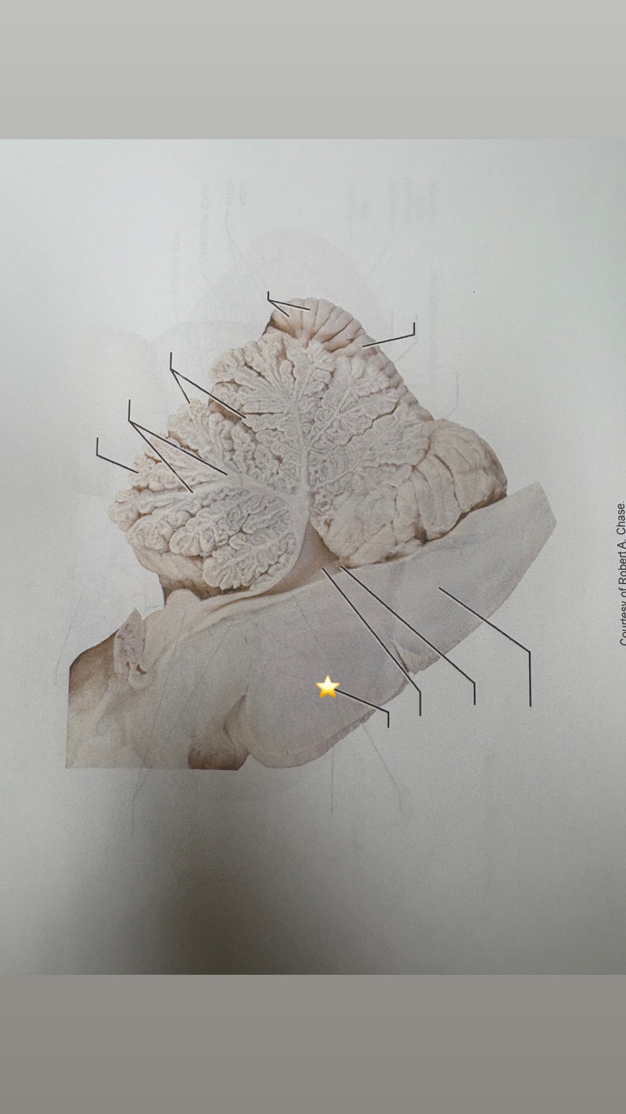 <p>name the starred structure</p>