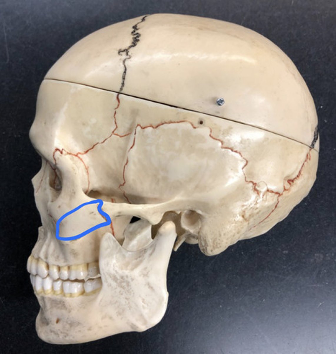 <p>The front part of the zygomatic arch</p>