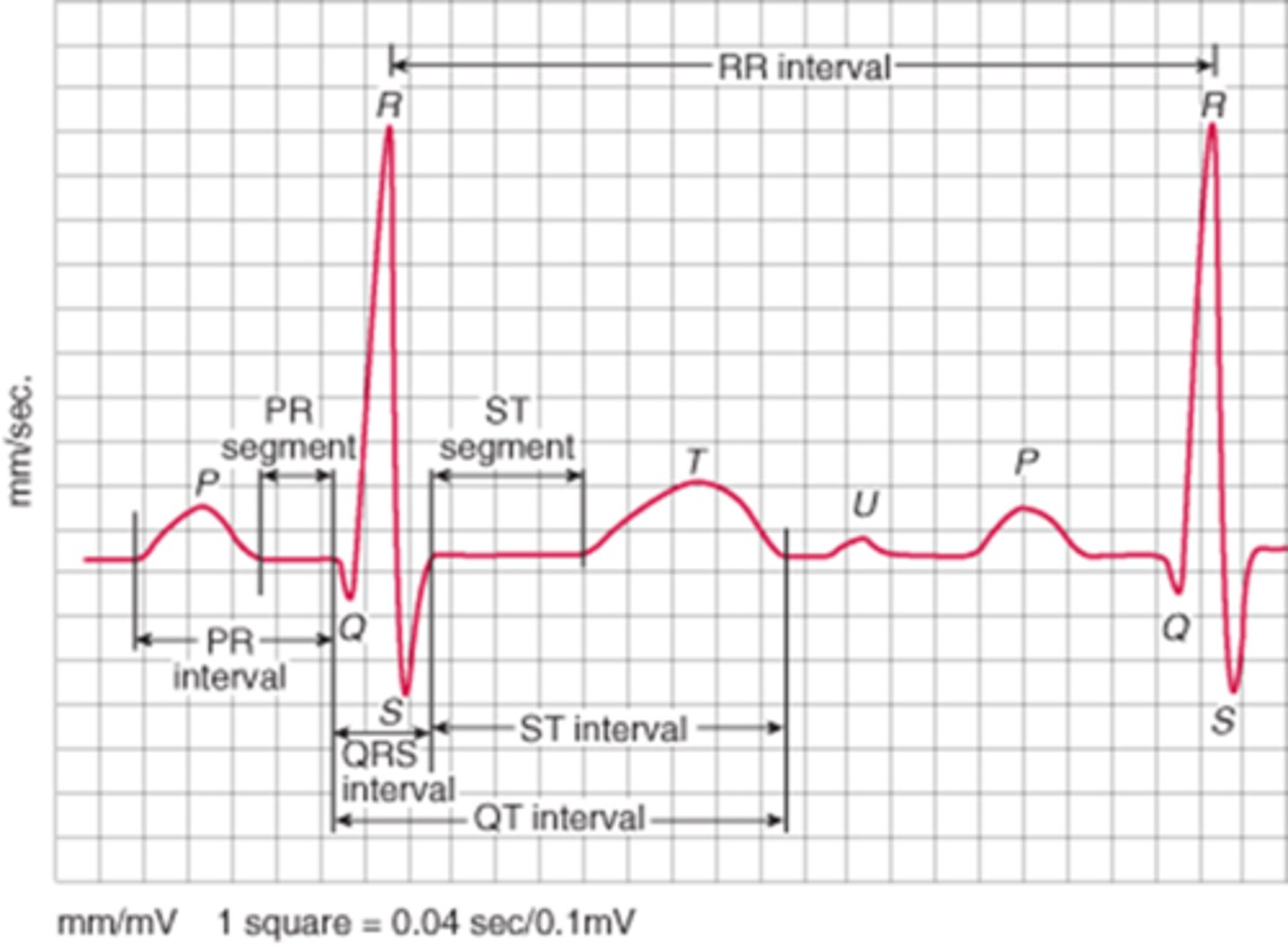 <p>Distance from one R wave to another; used to calculate rate</p>