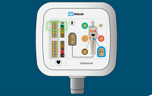 <ol><li><p>Serves as right leg ECG electrode and cancels out any powerline noise seen by the System Reference</p></li><li><p>On the patient’s right leg (front)</p></li><li><p>Connects to the RL ECG port on the SurfaceLink Module (see pic)</p></li></ol><p></p>