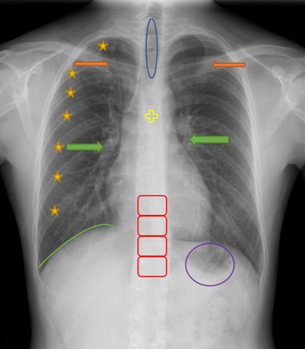 <p>Orange Arrows</p>