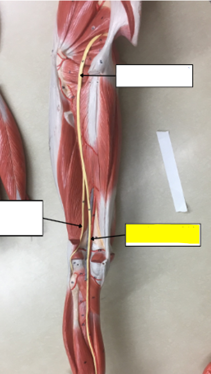 <p>what nerve is highlighted in yellow?</p>