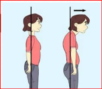 <p>Câu 56:<span style="color: blue;"> Nguyên nhân </span><span style="color: red;">thường gặp </span>của <span style="color: yellow;">tật cằm</span> và <span style="color: red;">đầu đưa về</span><span style="color: yellow;"> phía trước</span>?<span>&nbsp;</span></p><p class="MsoNormal">A. <span style="color: purple;">Yếu các cơ </span><span style="color: green;">duỗi cổ</span><span style="font-family: "Segoe UI Symbol", sans-serif; color: green;"><span>✓</span></span><span>&nbsp;</span></p><p class="MsoNormal">B. Yếu cơ gập cổ<span>&nbsp;</span></p><p class="MsoNormal">C. Co cơ ức đòn chũm<span>&nbsp;</span></p><p class="MsoNormal">D. Co cơ thang<span>&nbsp;</span></p>