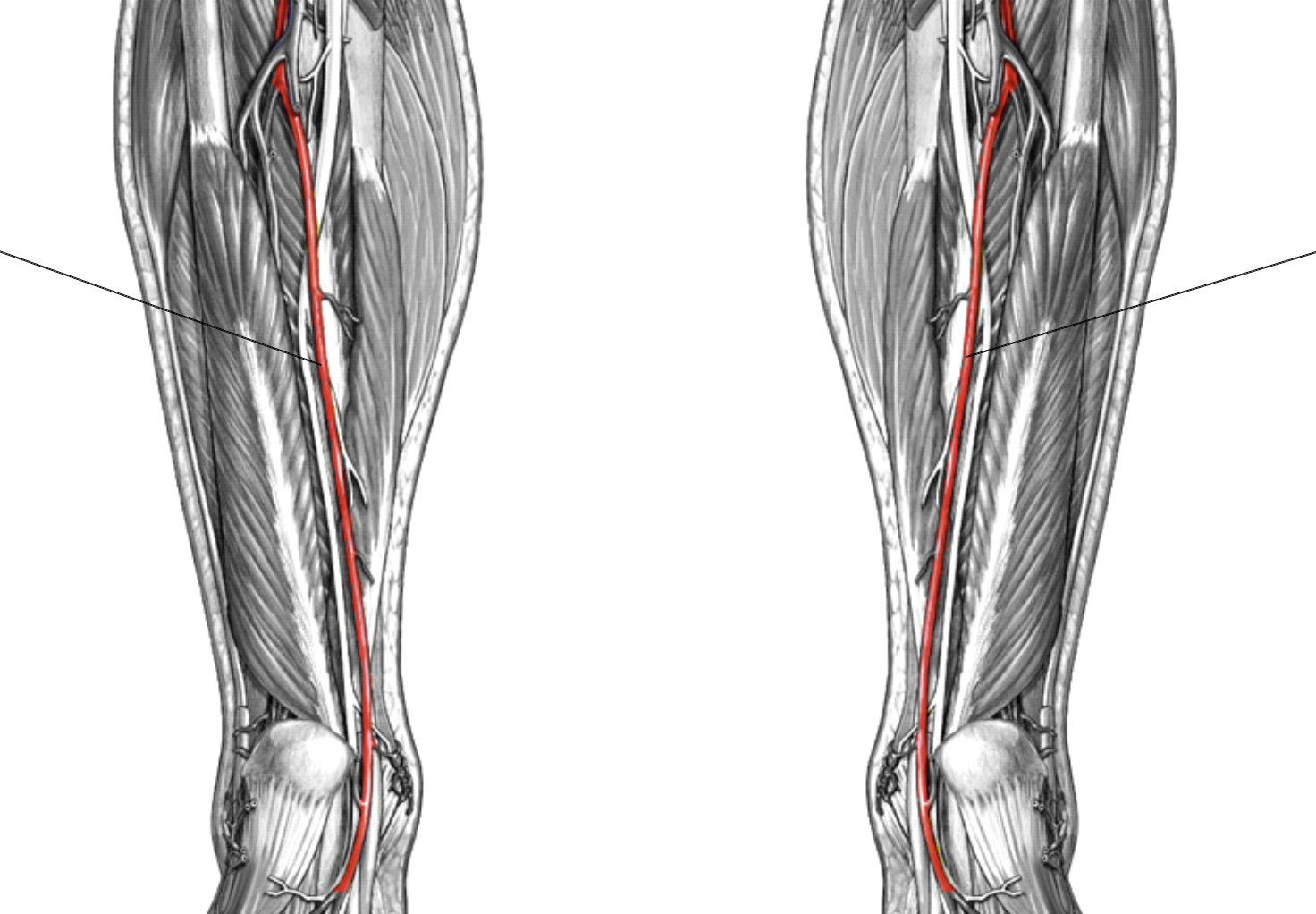 <p>Which arteries:</p><ul><li><p>Extends from popliteal artery</p></li><li><p>On posterior side of tibia bone</p></li></ul><p></p>
