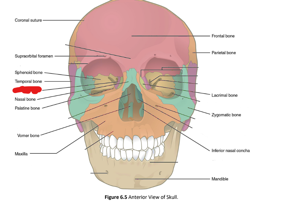 term image
