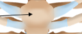 <p>Manubrium</p>