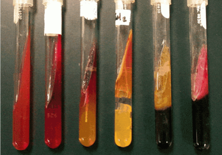 <p><span style="font-family: "Times New Roman";"><strong><span>Kligler’s Triple Sugar Iron (TSI) Agar Test</span></strong></span></p>