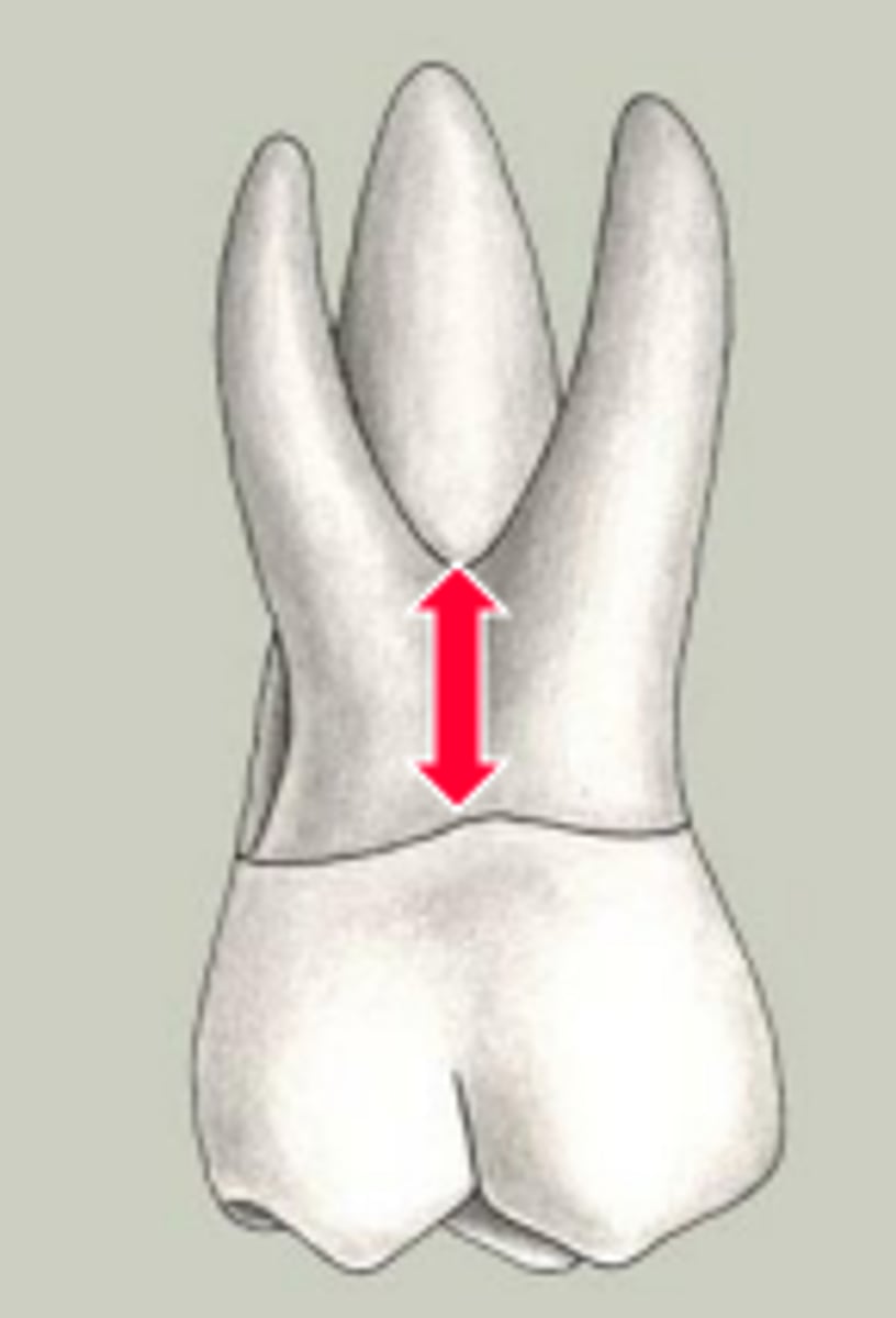 <p>portion of multirooted tooth that is not split or furcated</p>