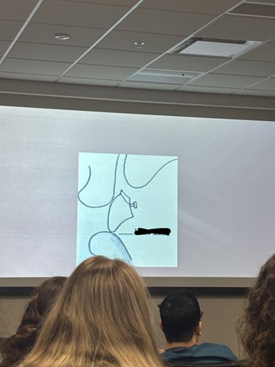 <p>T/F this is the wet line</p>