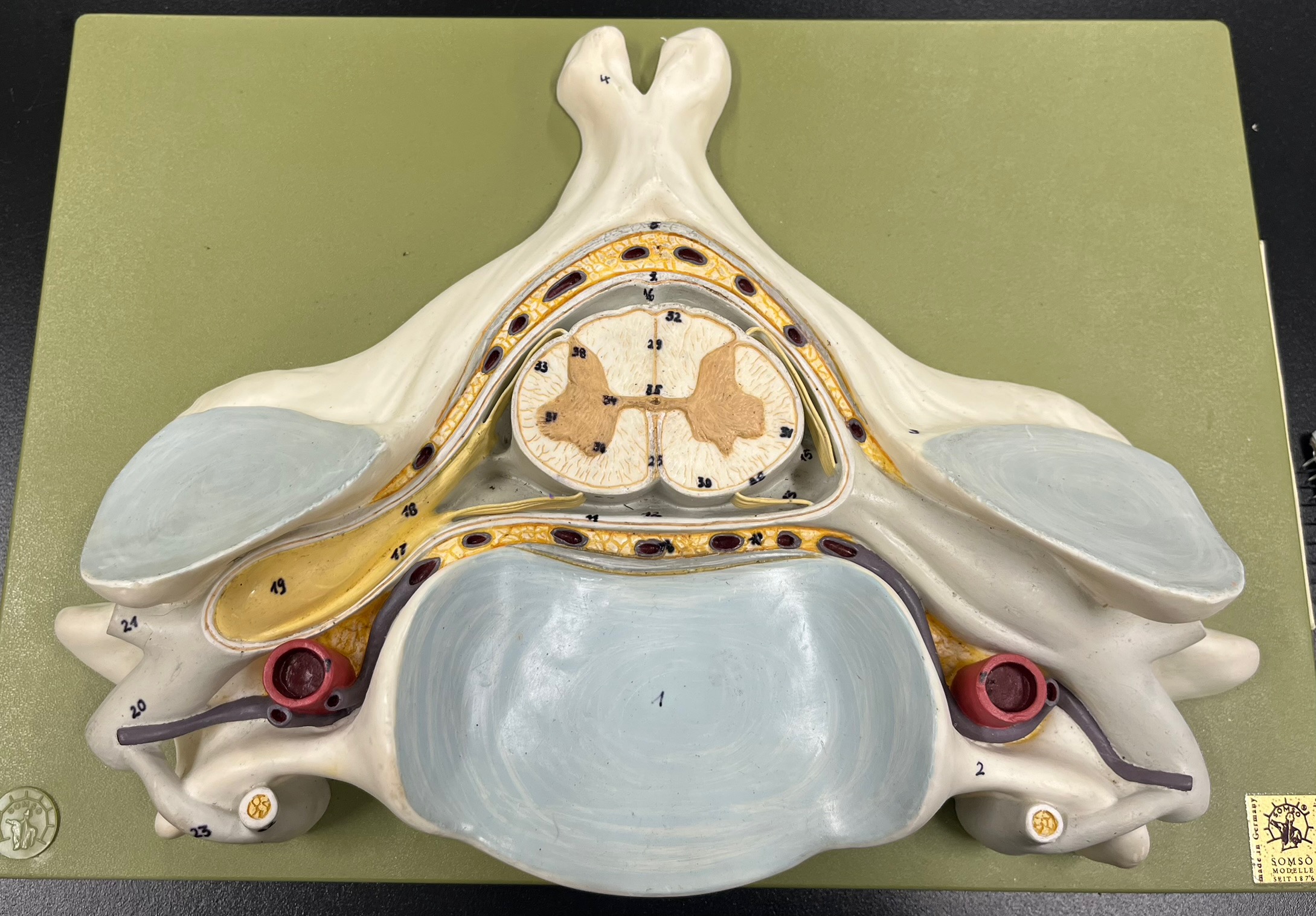 <p>posterior column</p>