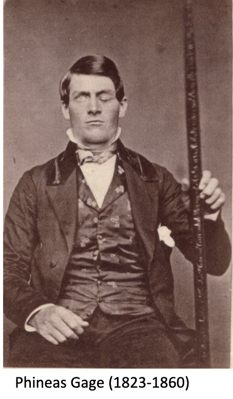 <p>the case of phinease gage demonstrates what about the prefrontal cortex?</p>