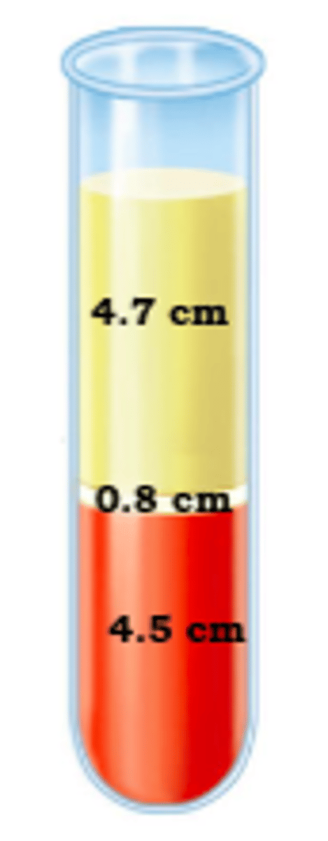 <p>45%</p>