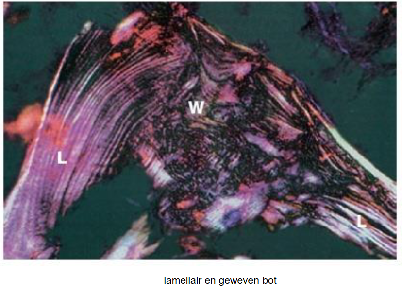 <ul><li><p>matuur lamellair bot</p></li><li><p>geweven (‘woven’) bot</p></li></ul><p></p>