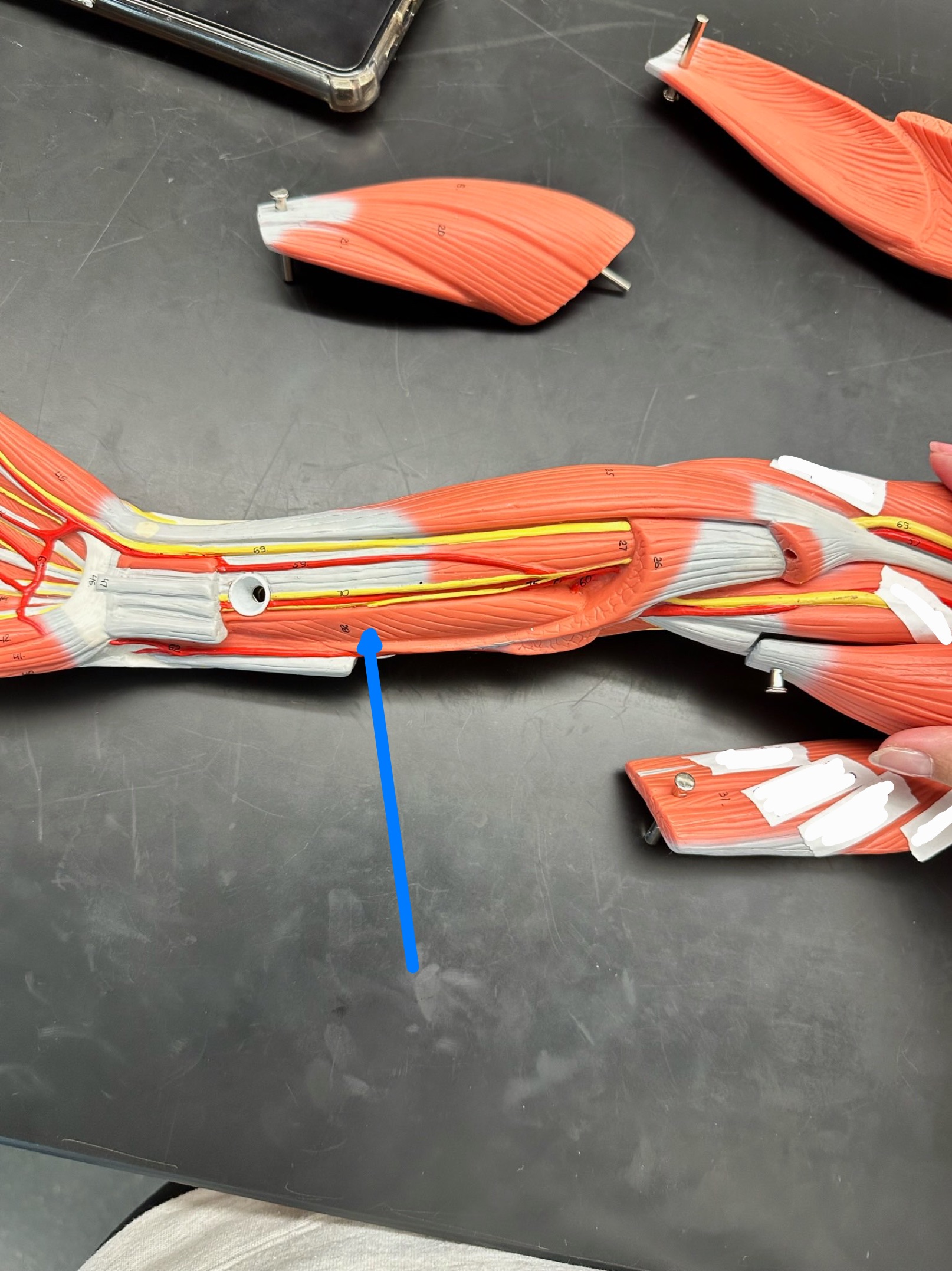 <p>ID muscle</p>