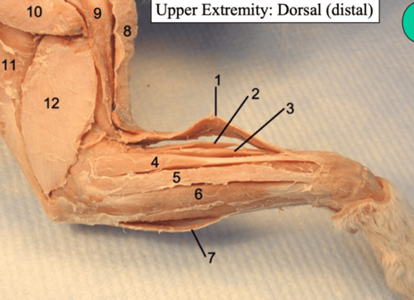 <p>what upper extremity: Dorsal(distal) muscle is number 5?</p>