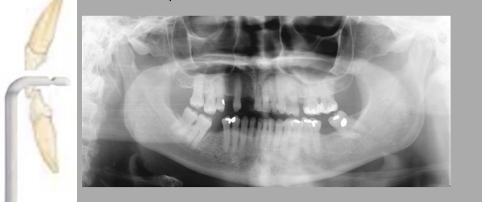 <p>What error is this?</p>