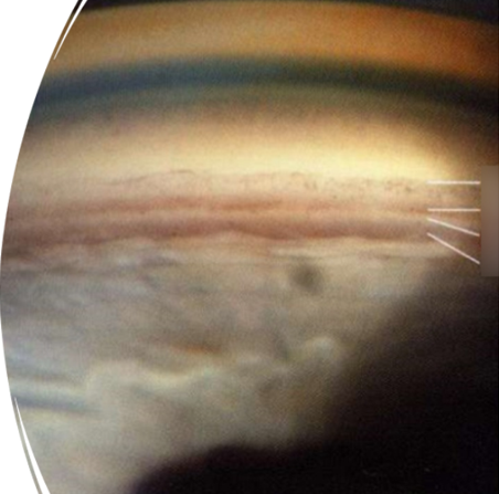 <p>what is the most posterior structure in this image</p>
