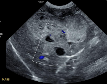 <ul><li><p>Diagnostic process</p><ul><li><p>evaluate for progression/extent of disease</p></li></ul></li><li><p>BW, UA, Bio chem</p></li><li><p>Xray → 3 views</p></li><li><p>US - abdomen</p></li><li><p>LN aspiration</p><ul><li><p>Enlarged nodes</p></li><li><p>Draining/sentinel LN (popliteal drains the foot)</p></li></ul></li><li><p>MRI, CT</p></li></ul><p></p>