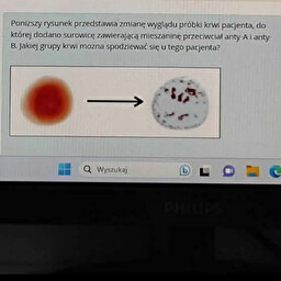 <p><span><span>dodano przeciwciala anty - A i anty - B. jaka krew tu jest?</span></span></p>