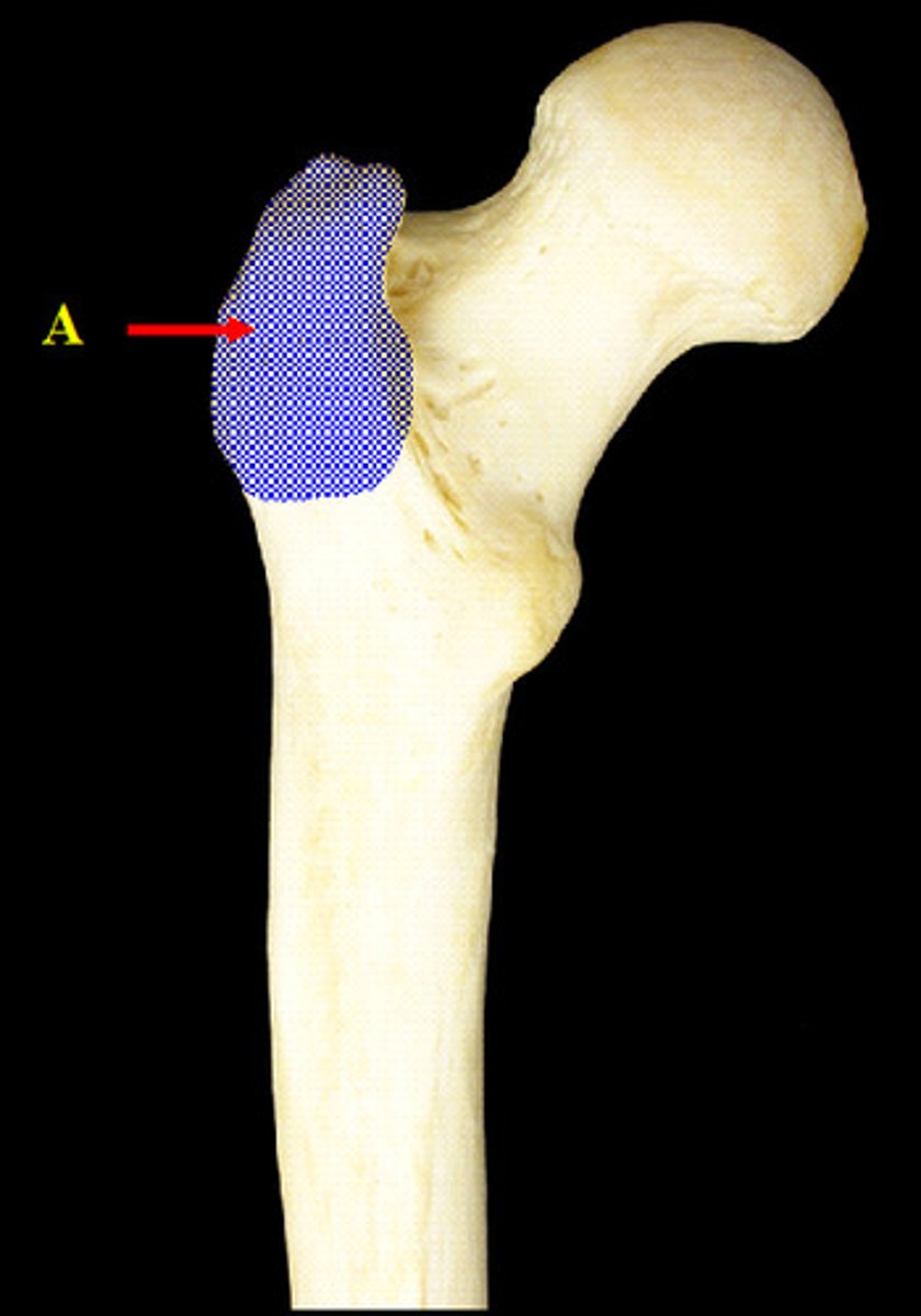 <p>Large, blunt non articular prominence on the lateral, proximal part of the femur</p>