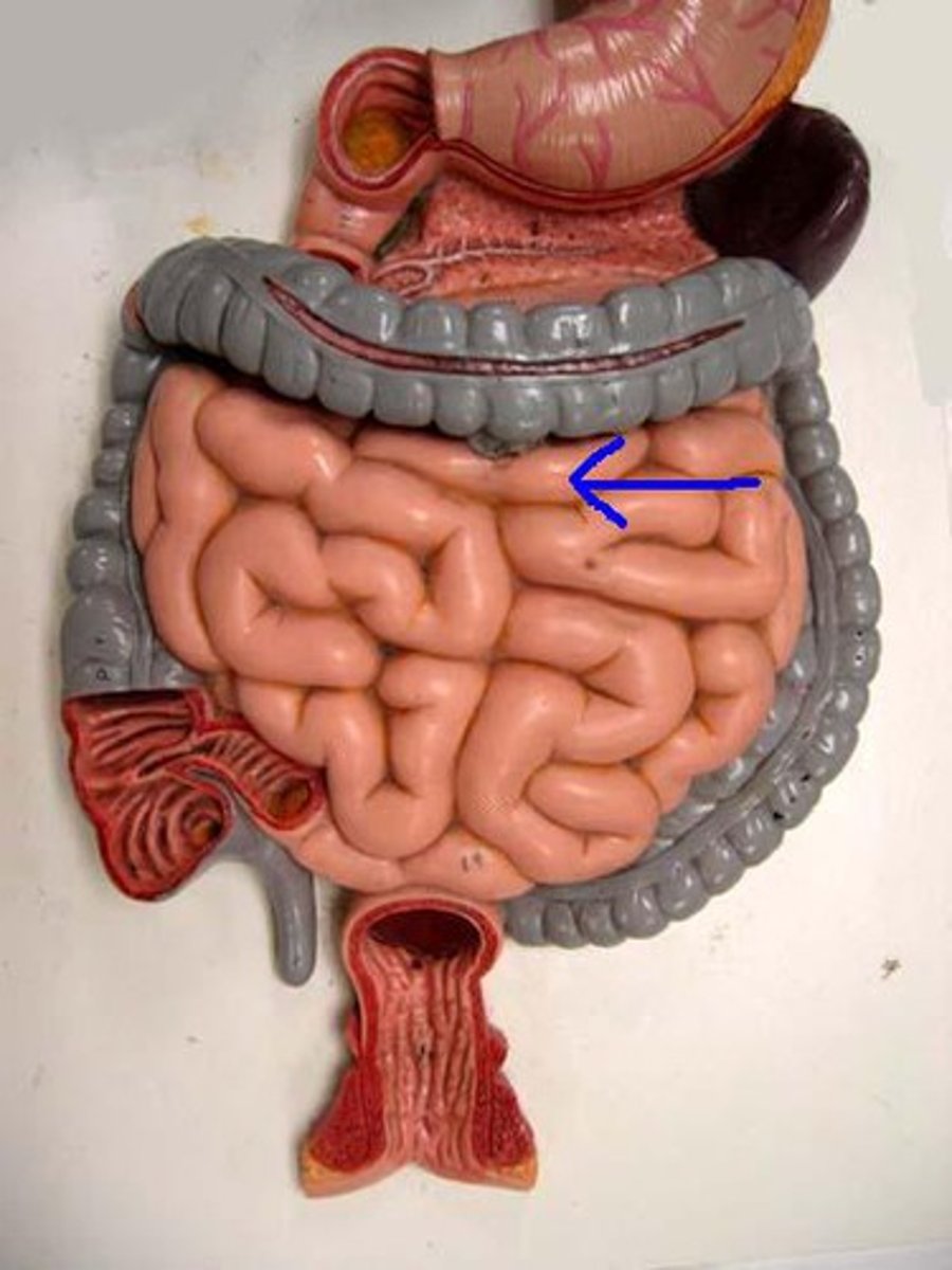 <p>Specific</p>