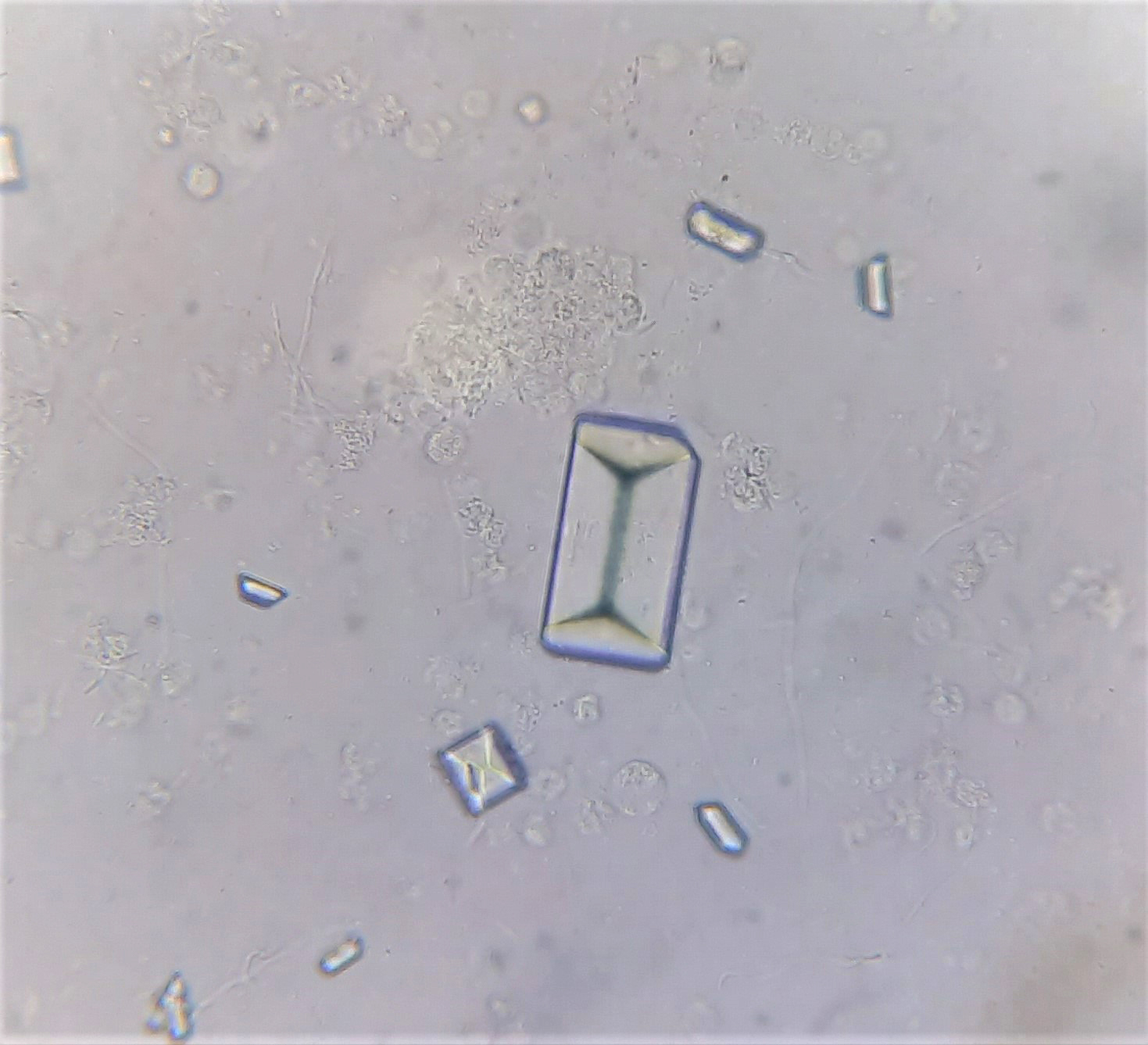 <ul><li><p class="">Amorphous phosphates</p></li><li><p class="">Calcium carbonate</p></li><li><p class="">Triple phosphate (struvite) pictured</p></li><li><p class="">Ammonium biurate</p></li></ul><p></p>