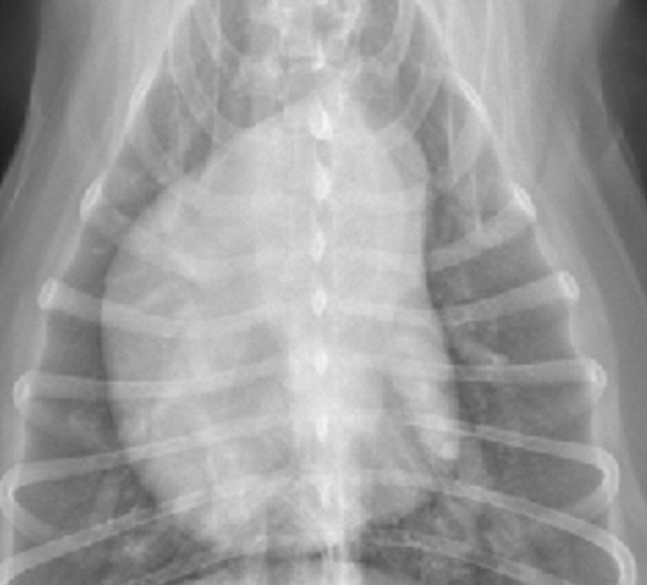 <p>What shape do you see in this heart with dirofilariasis?</p>