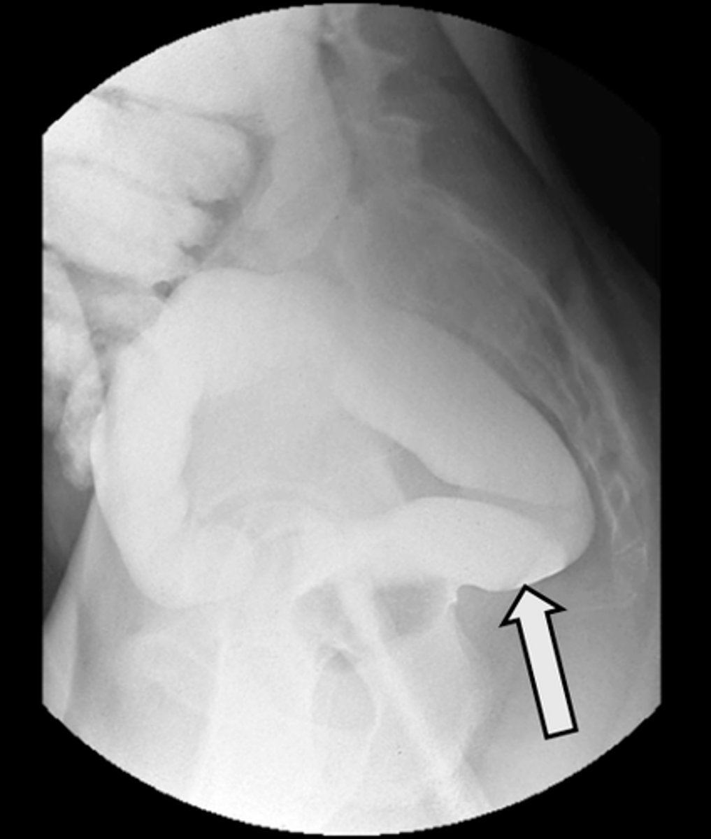 <p>What is indicated in the image?</p>