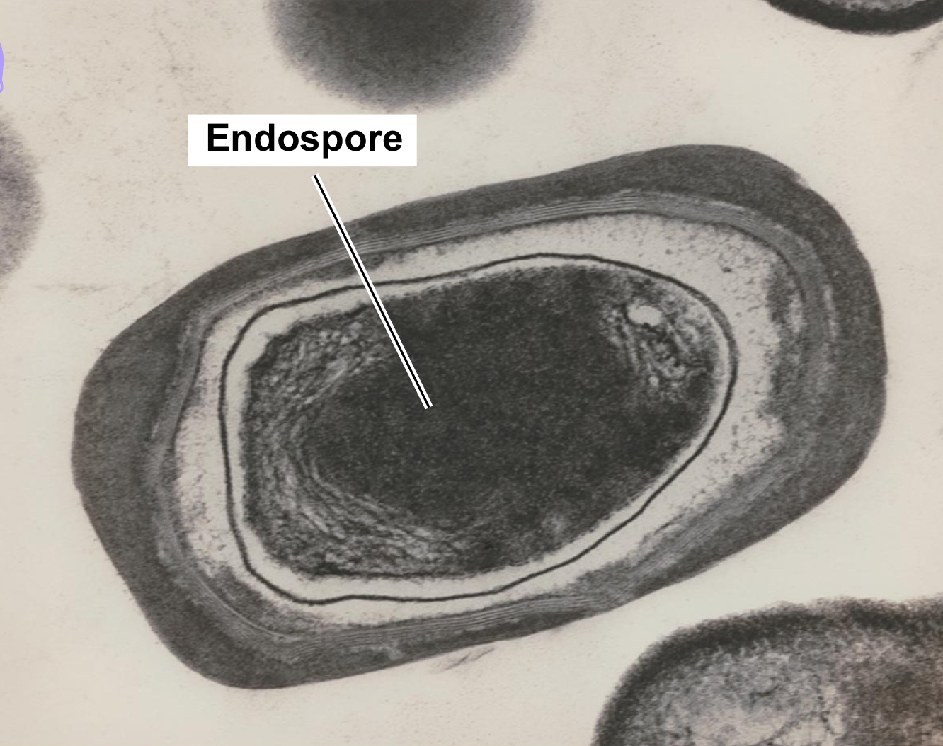 <p>Dormant, resistant cells produced by certain bacteria (e.g., Bacillus, Clostridium) when nutrients are scarce.</p>