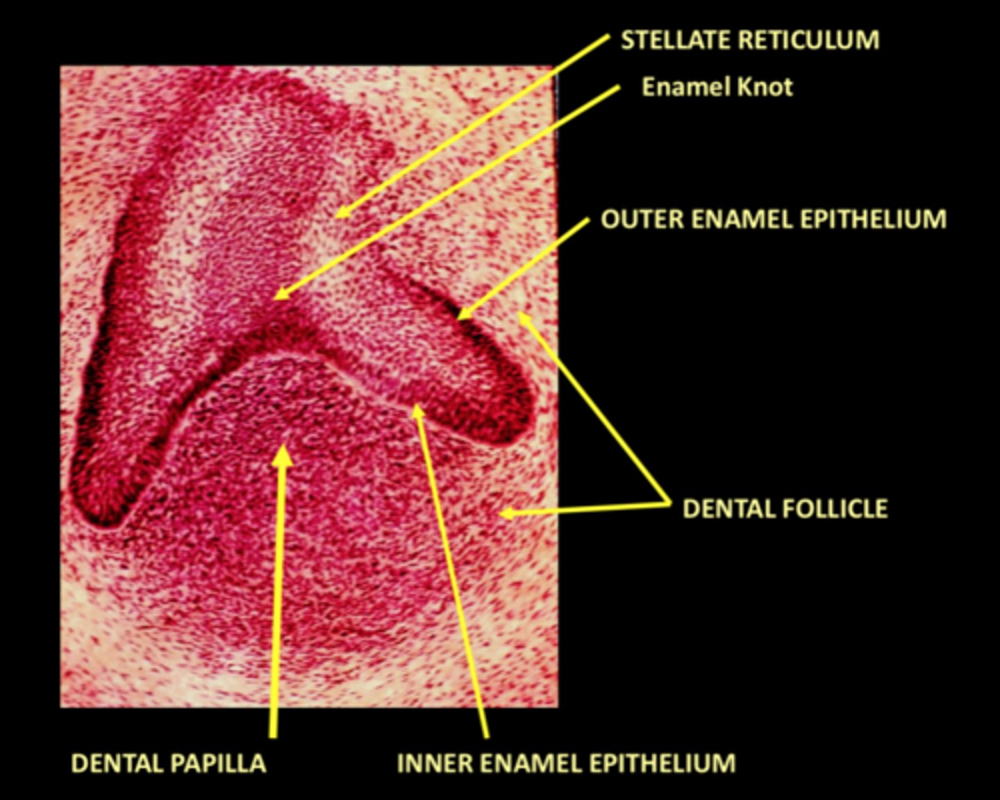 <p>3rd stage when a fourth layer of epithelium appears, stratum intermedium</p>