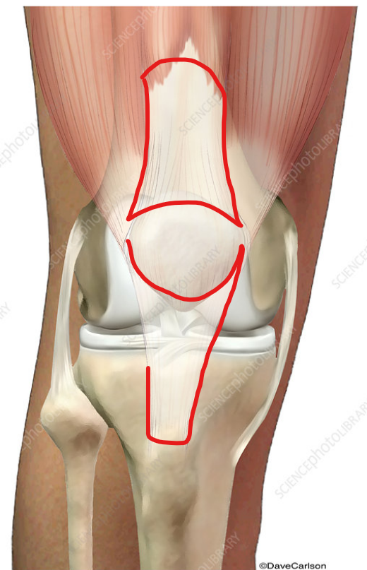<p>What are the red areas called?</p>