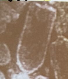 <ul><li><p><strong>Enveloped = Herpes and smallpox&nbsp;</strong></p></li><li><p><strong>The envelope is taken from the host cell!&nbsp;</strong></p></li></ul><p></p>