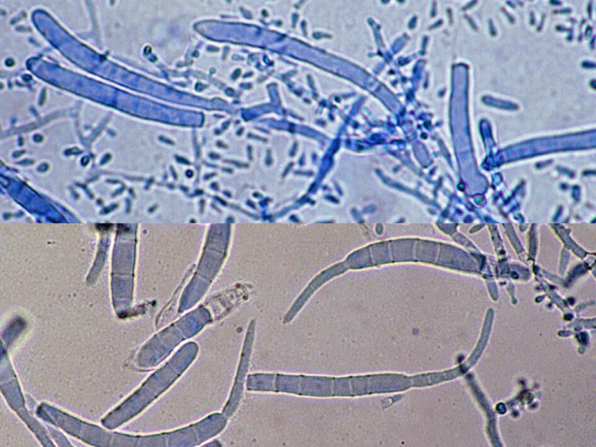 <p>What dermatophyte is this?</p>