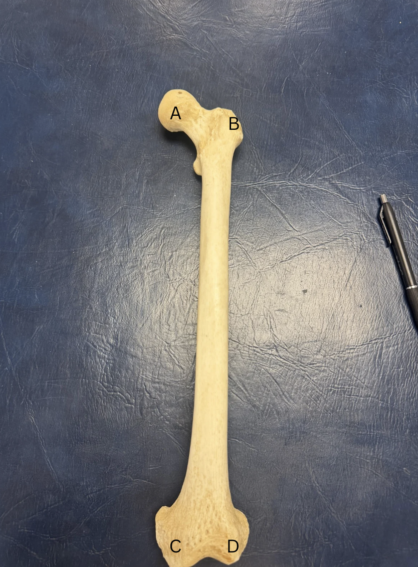 <p>Label the Femur</p>