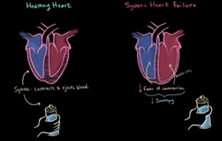 <p><span style="font-family: &quot;Century Gothic&quot;, sans-serif;">Occurs when the left ventricle is unable to contract well against volume and unable to eject blood volume into the aorta</span></p>