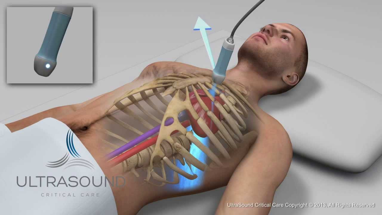 <p>What type of transducer is typically used for cardiac echocardiography, and what is its frequency range?</p>