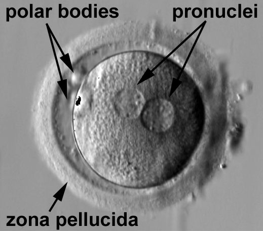 <p>Zygote approximately 12 to 15 hours after fertilization (human).</p>