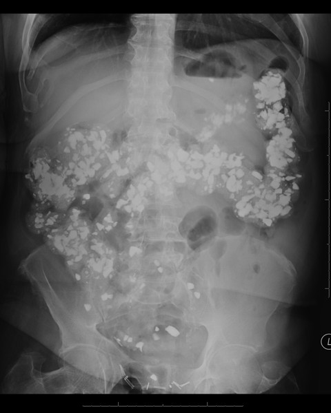 <p>what is this an image of?</p>