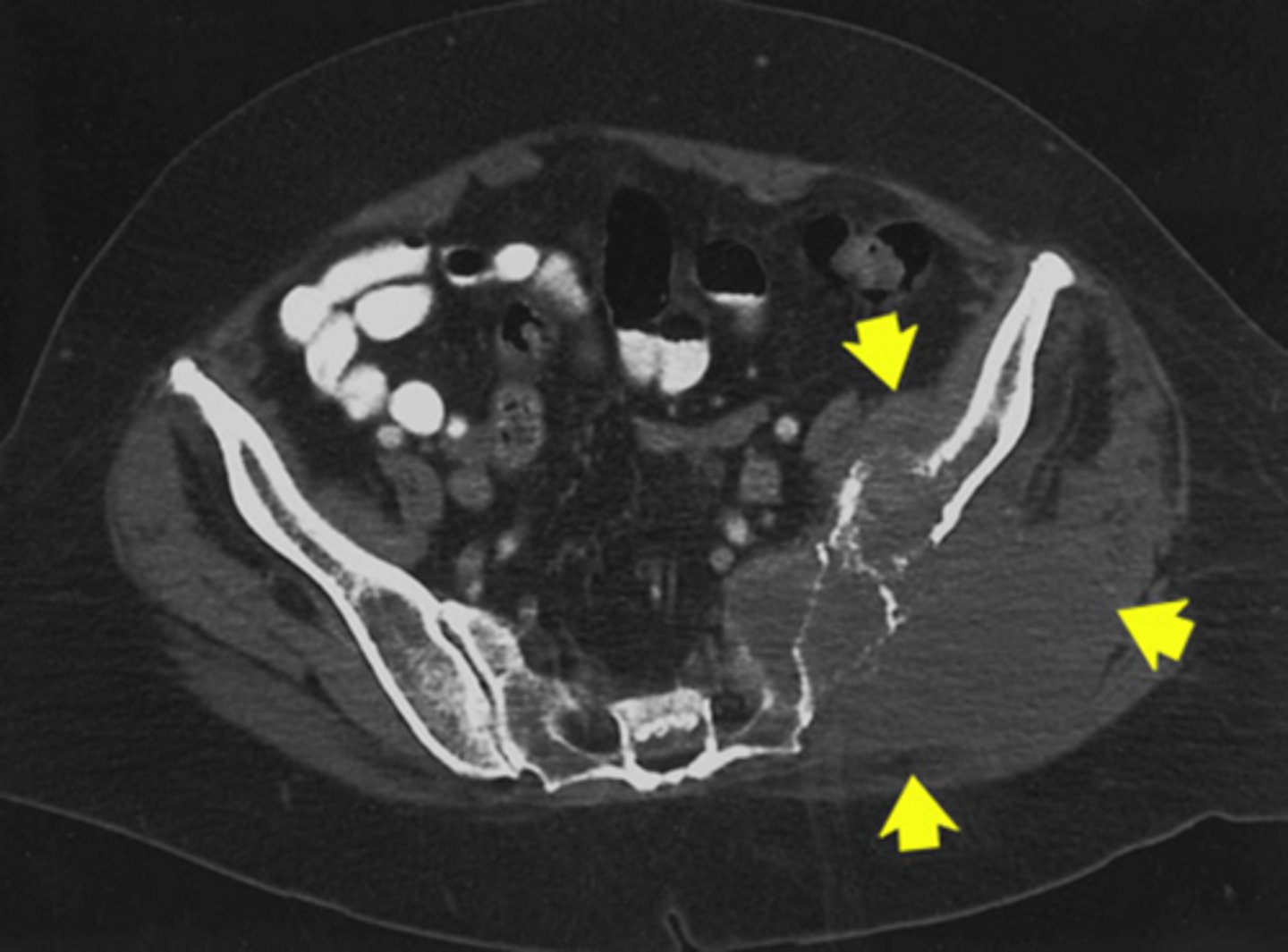 <p>What type of pathology is this</p>