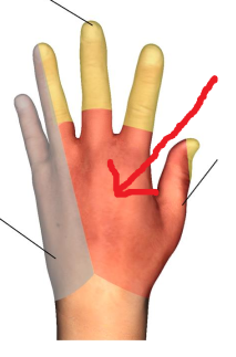 <p>The area where the red arrow is pointing is what dermatomal nerve? </p>