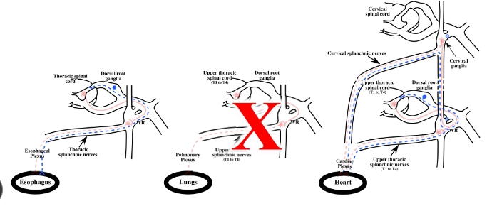 <p>-GA axons returning with sympathetic nerves mediate pain</p><p>-pain can be caused by distension of esophagus or insufficient blood flow to heart (myocardial ischemia)</p><p>-GA axons returning from esophagus and heart with cervical and/or upper thoracic splanchnic nerves</p><p>-there are NO GA axons returning with splanchnic nerves from the lungs, so they are insensitive to pain</p>