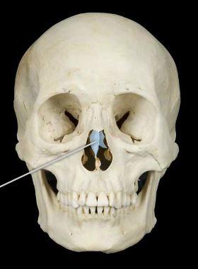 <p>Identify the projection.</p>