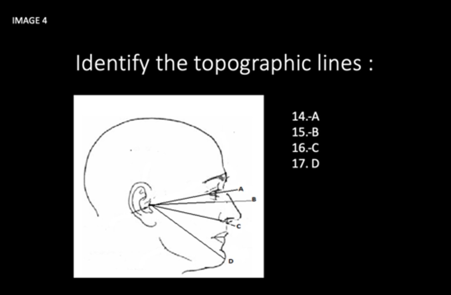 <p>Identify the topographic line:</p><p>What is C?</p>