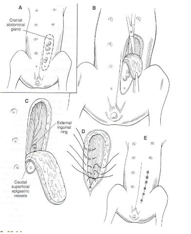 <p>'radical excision', can be unilateral or bilateral</p><p>include lymph nodes in resection</p>