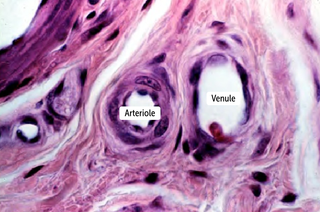 <p>Venules</p><ul><li><p>the smallest of the veins </p></li><li><p>They have a tunica intima like that of arteries but a thin tunicae media and adventitia. </p></li><li><p>Postcapillary venules lack the smooth muscle cells and elastic fibers that characterize the tunica media, so postcapillary venules have much less capacity to stretch (because of a lack of elastic) and vasoconstrict (because of an insufficient number of smooth muscle cells). </p></li><li><p>Postcapillary venules drain into muscular venules before draining into veins.</p></li></ul><p></p>