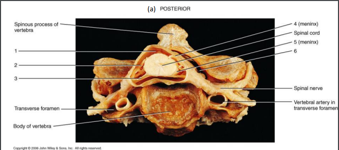 <p>1 (ON VERTEBRA)</p>