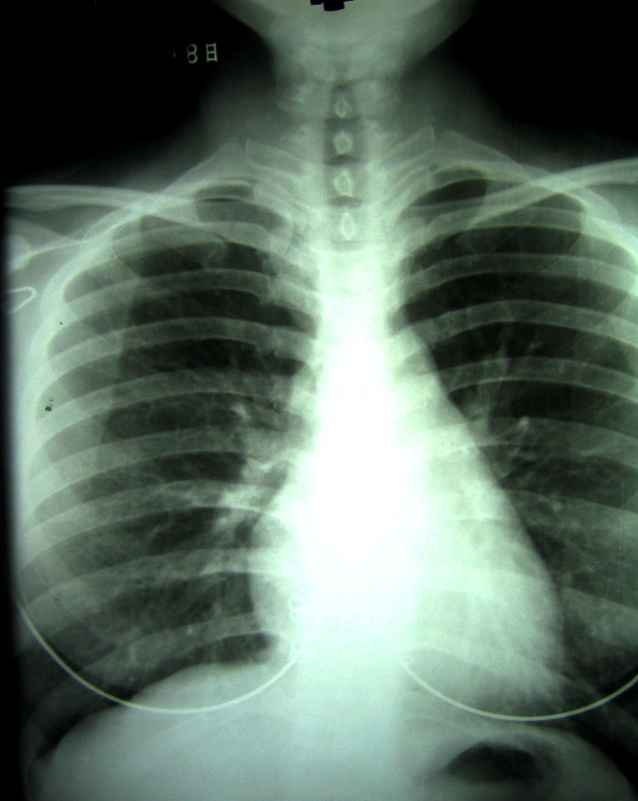 <p>Does this radiograph have high or low contrast?</p>