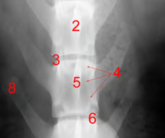 <p><span><span>Identify structure 6:</span></span></p>